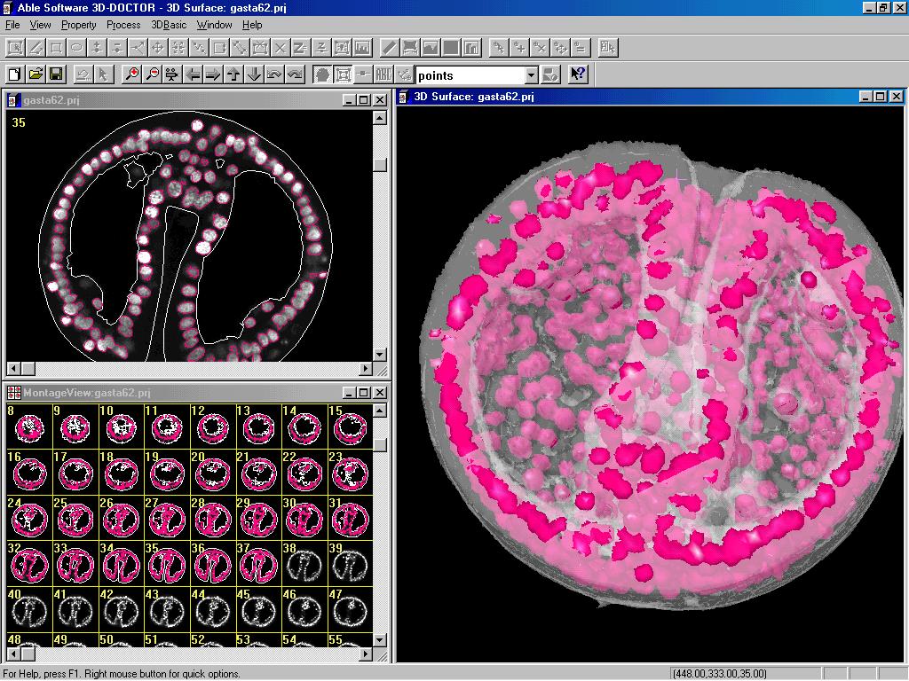 [صورة: gastrula.jpg]