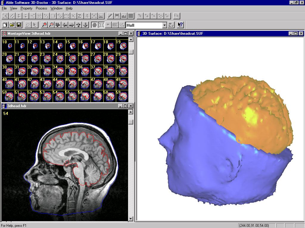 Raster meets vector with 3D-DOCTOR