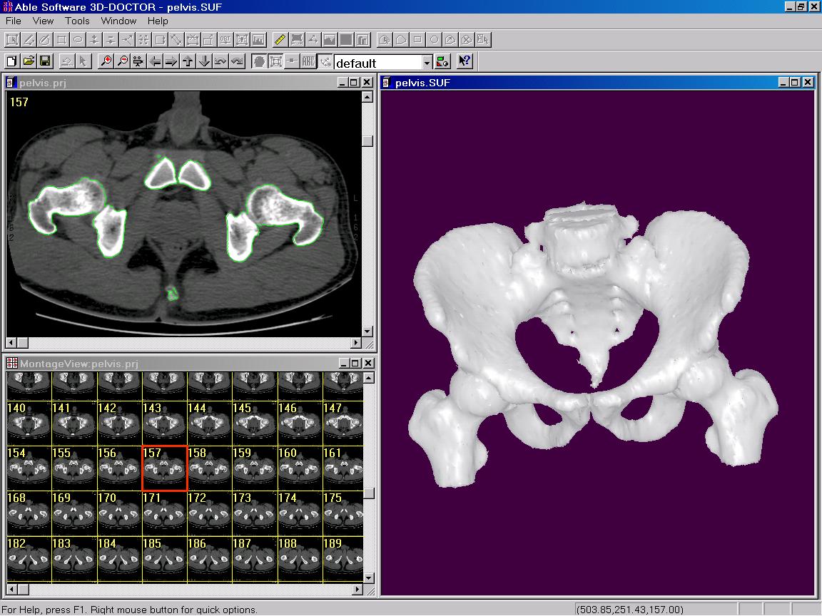 Pelvis 3D