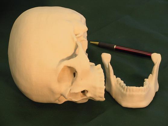 Dental Model